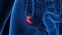 الزائدة الدودية