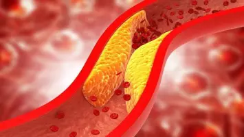 الكوليسترول