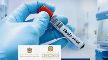 ايبولا