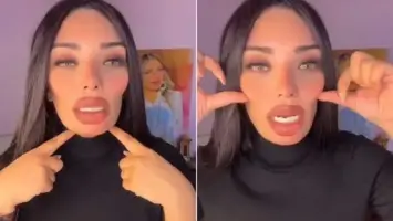 فيديو مؤثر.. فتاة مصرية تستعرض تفاصيل التغيرات القاسية في وجهها بعد عملية تجميل