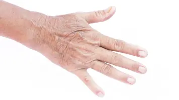 إنجاز علمي في أستراليا: تطوير عينات جلدية تحاكي الجلد البشري