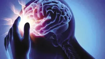 السكتة الدماغية