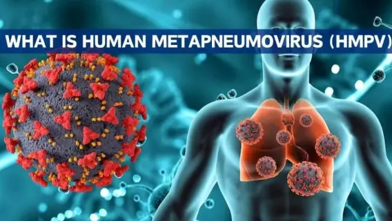 Human Metapneumovirus (HMPV): Transmission, Symptoms, and Treatment Explained