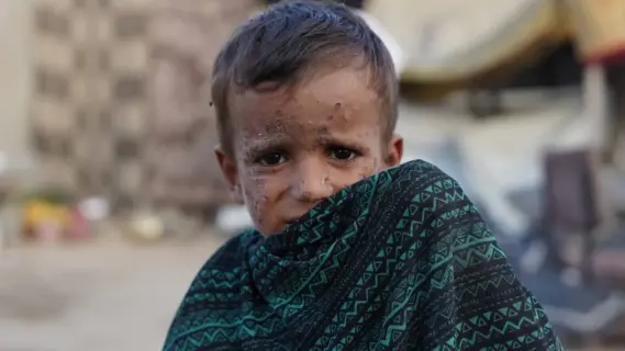 وفيات غيلان باريه تشعل القلق في غزة وسط دعوات للتحرك السريع