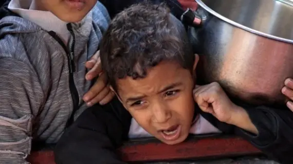 ارتفاع حصيلة ضحايا الجوع في غزة إلى 251 بينهم 108 أطفال