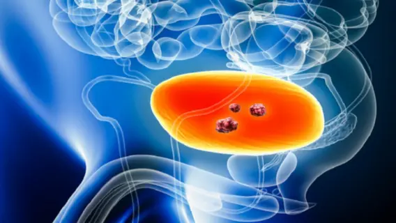 وفاة أمريكي بسبب مرض نادر من لسعة بعوض