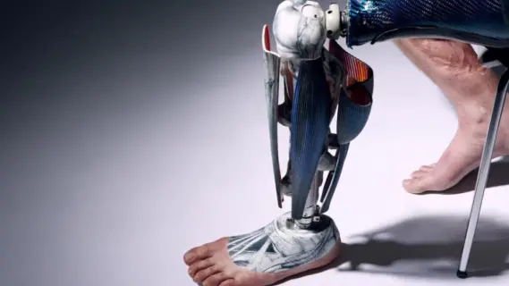 ابتكار ثوري: تطوير أول ساق آلية بعضلات اصطناعية تحاكي الحركة البشرية
