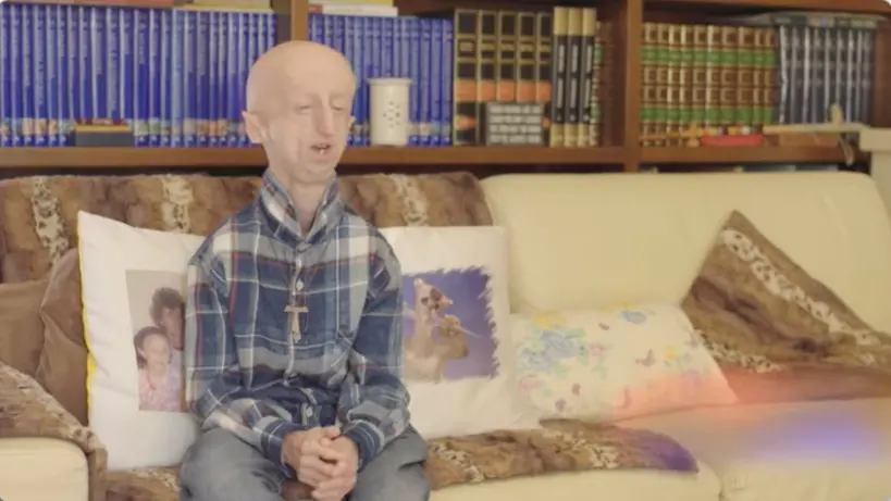 وفاة "سامي باسو" أكبر المصابين بمرض الشيخوخة المبكرة